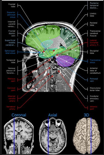 IMAIOS e-Anatomy